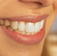 Sbiancamento dentale